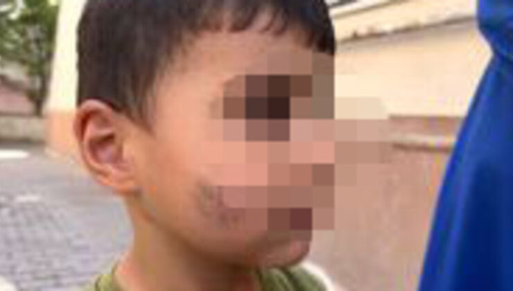 Evde uyuyan çocuğu lağım faresi ısırdı!