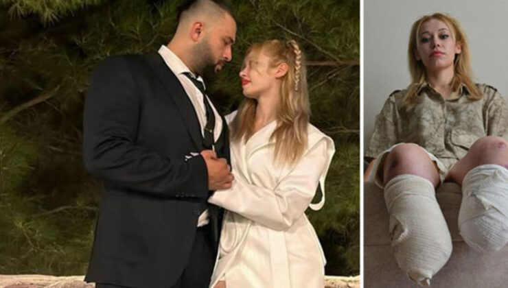 Evlilik yıl dönümünde kâbusu yaşadı! İki bacağını kaybetti…