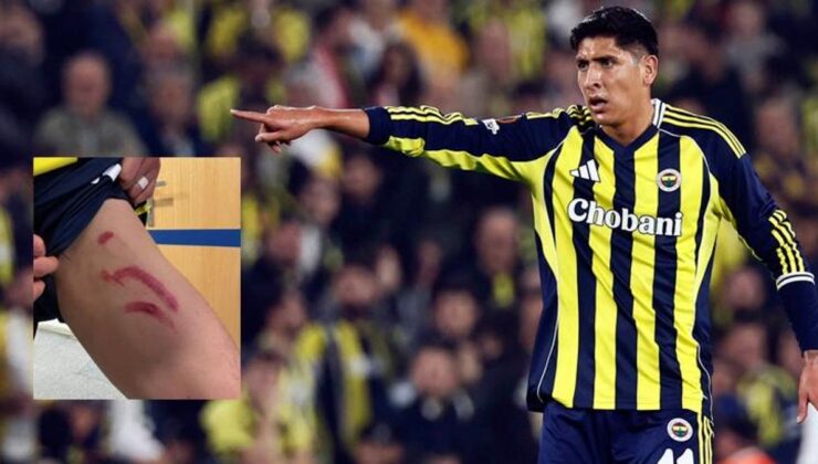 Edson Alvarez’in sakatlığında son durum! Stuttgart maçının ardından bacağının durumunu paylaşmıştı