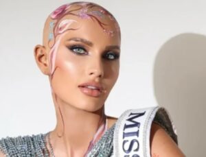 Saçsız güzel Mary Sickler ABD Güzellik Yarışması’na peruğu olmadan katıldı