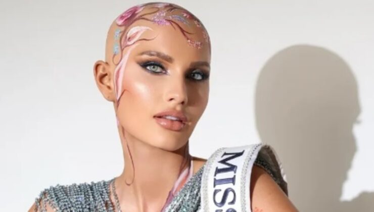 Saçsız güzel Mary Sickler ABD Güzellik Yarışması’na peruğu olmadan katıldı