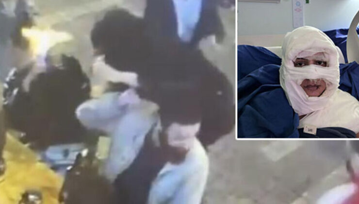 Eğlence mekanında genç kadını ateşe verdi!