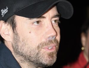 Murat Dalkılıç’tan burun ameliyat açıklaması