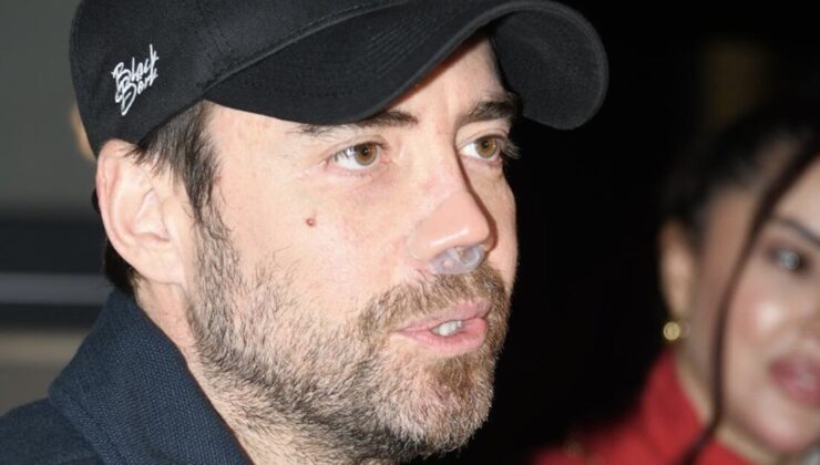 Murat Dalkılıç’tan burun ameliyat açıklaması