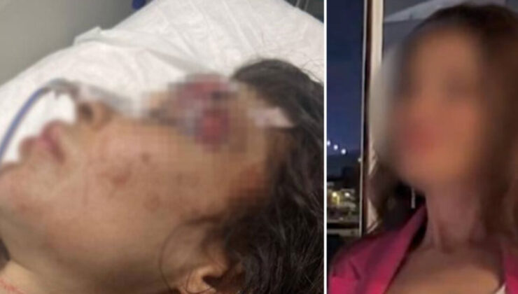 Sibel’i yumrukla darp eden boksör bıçaklamıştı… Kan donduran detaylar ortaya çıktı!