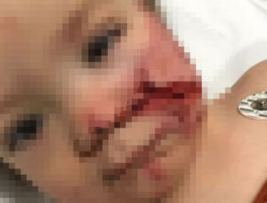 Ankara Valiliği’nden 2 kardeşe saldıran pitbull ve sahibiyle ilgili açıklama!